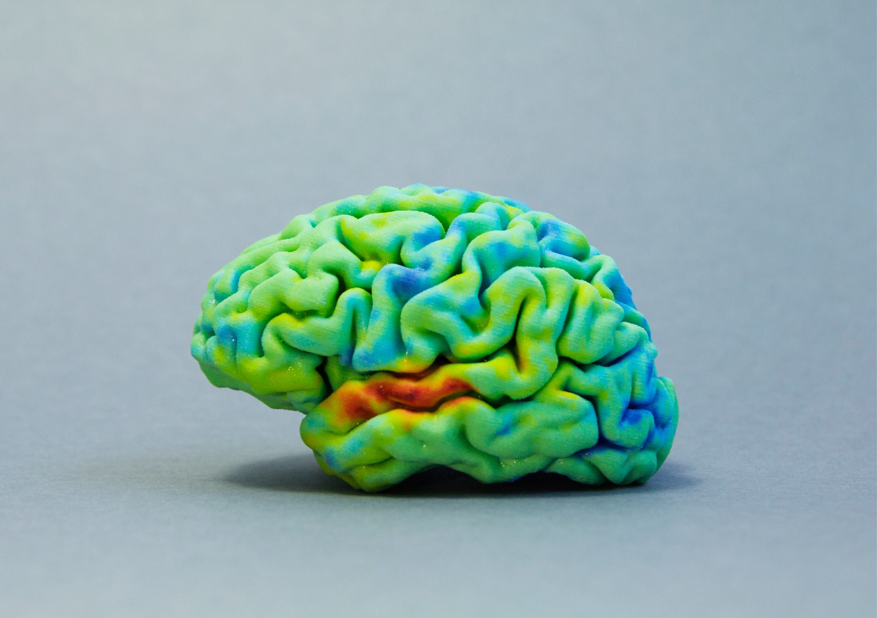 How to: 3D print your own brain using MRI or CT scans & free software | Sculpteo Blog