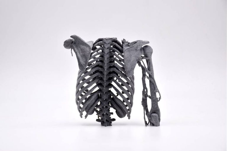 Sculpteo 3D Printed anatomic model from Slicer 3D