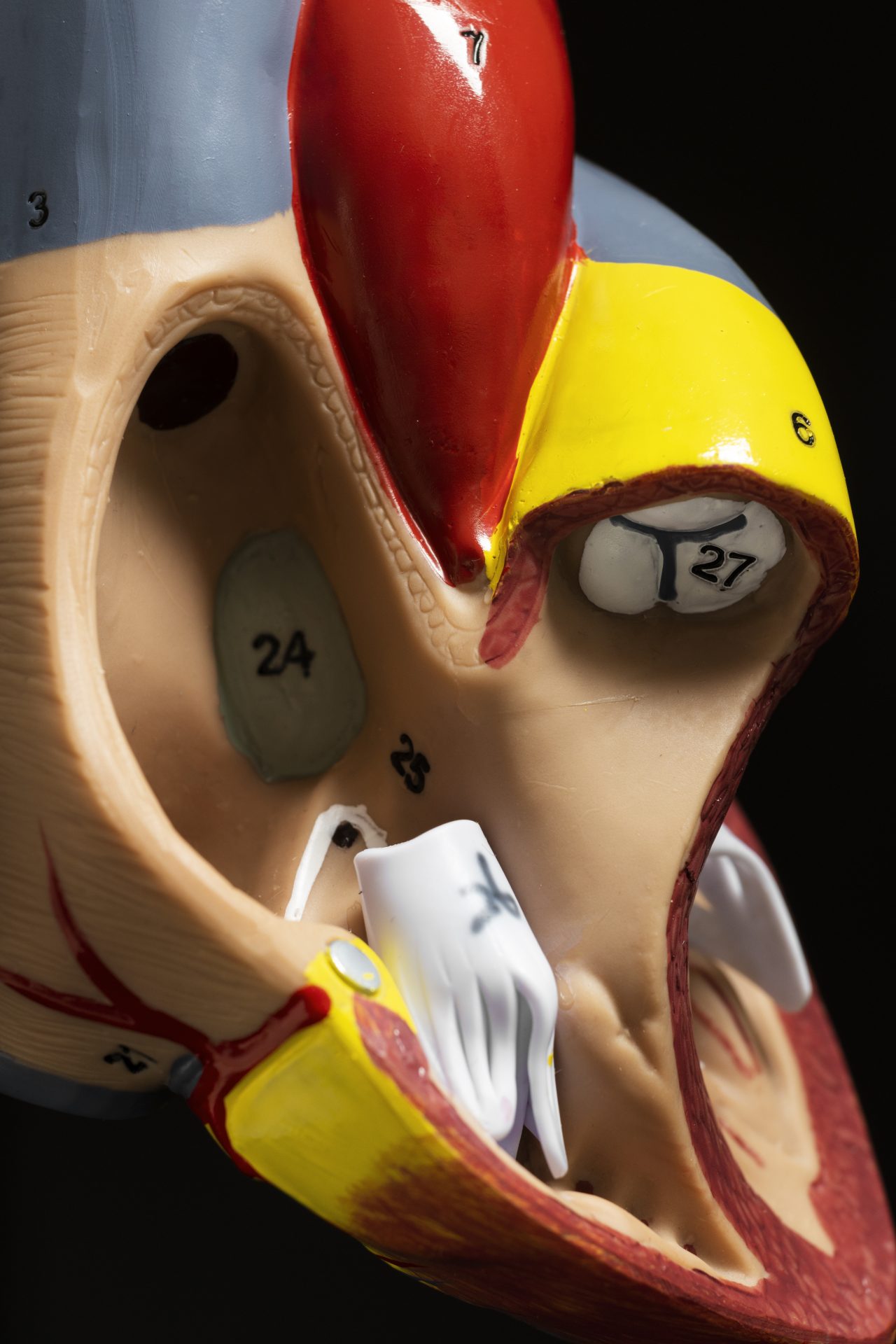 3D printed surgical guide