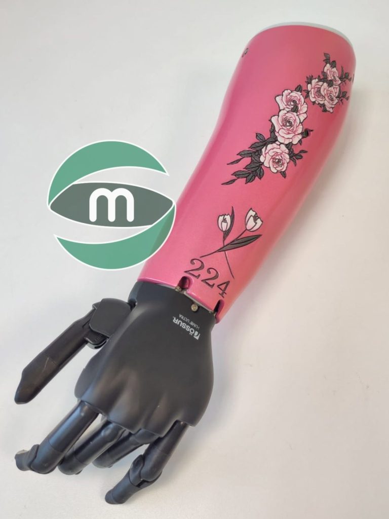 Make sense pink arm Prosthetic, with flower design