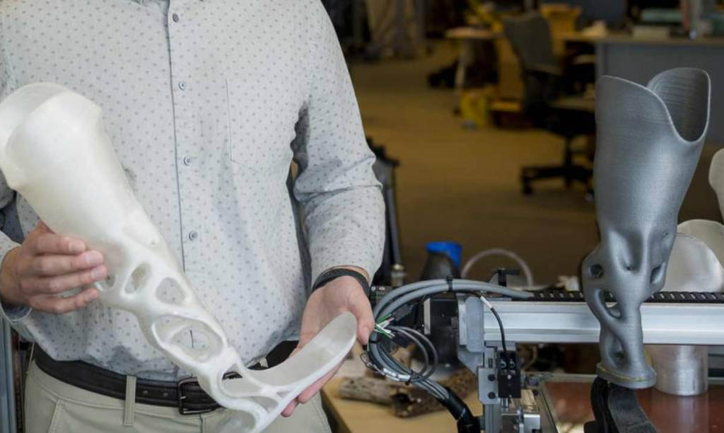3d printed prosthetic legs