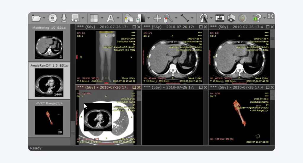 DICOM scan
