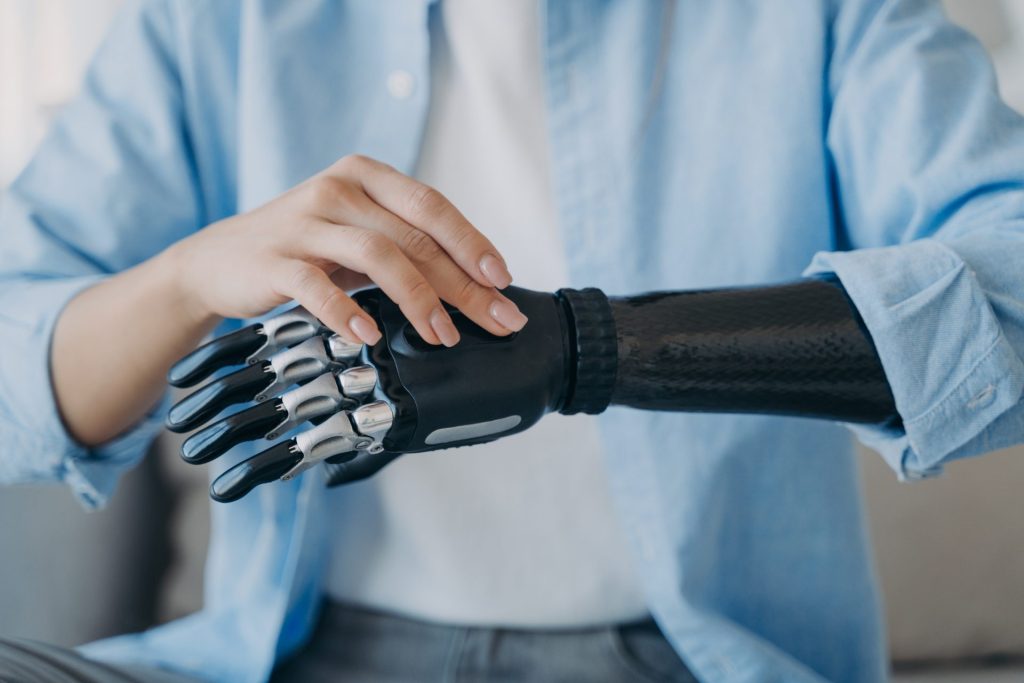 3d printed arm prosthetic bionic robotic hand technology
