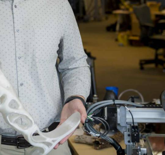 3d printed prosthetic legs