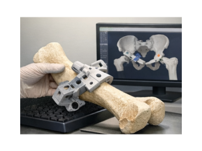 3D printed surgical guide steps